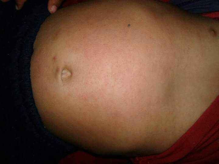 Imagen foto_00000001