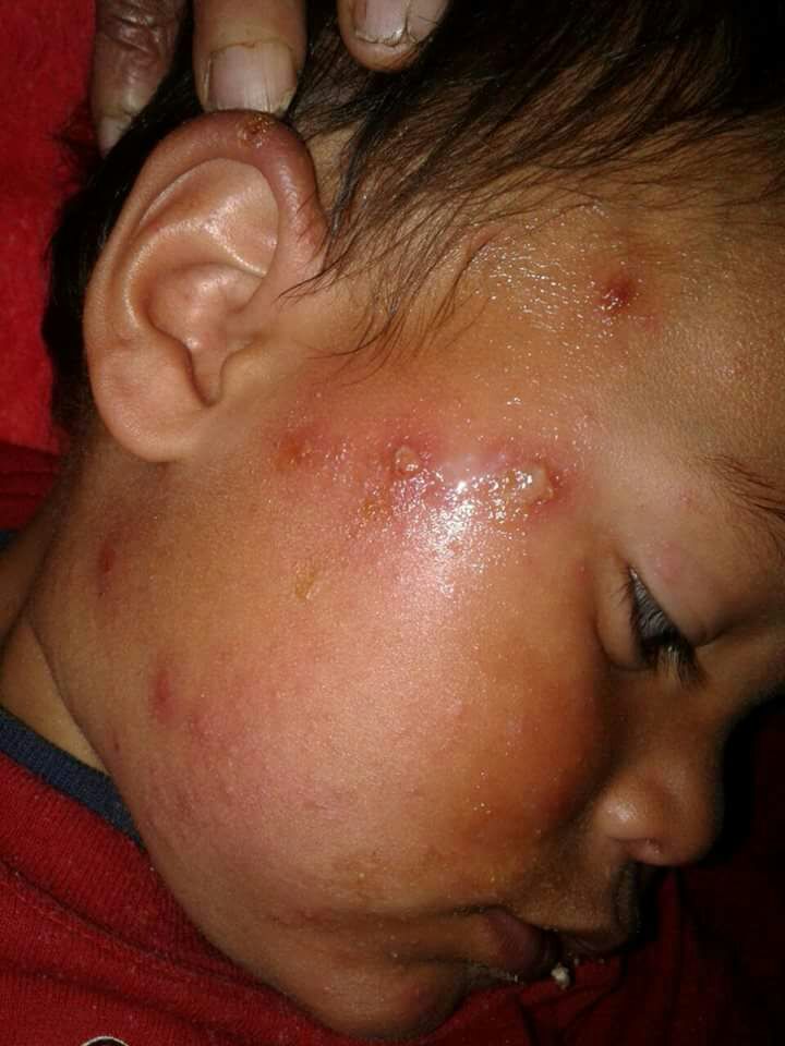 Imagen foto_00000007