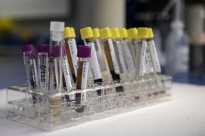 Bancada Verde solicita a la alcaldesa reforzar estrategia con laboratorios para incrementar realización de pruebas COVID-19