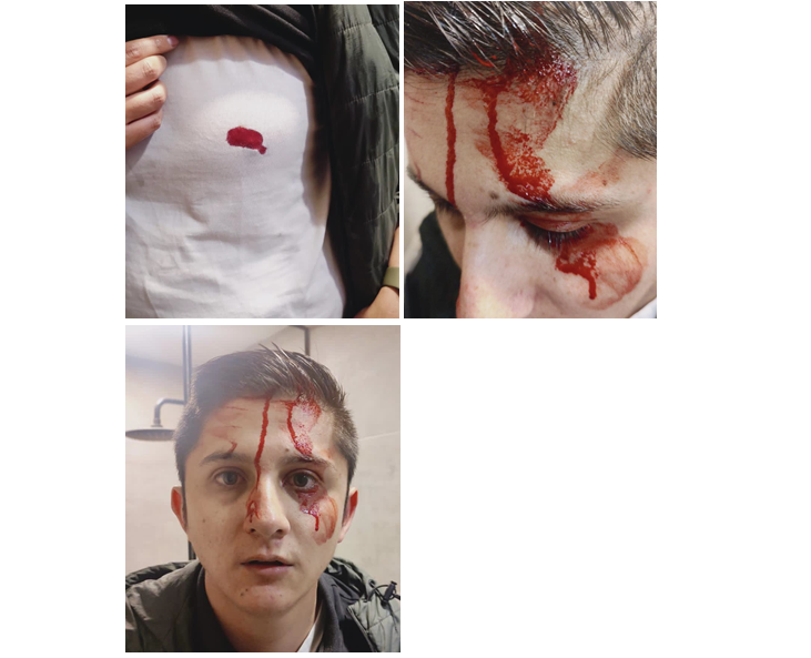 conjunto de tres fotografias donde se ven las heridas causadas por los delincuentes